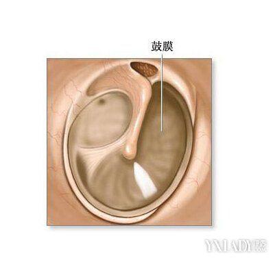 成都仁品股膜穿孔wc手術(shù)