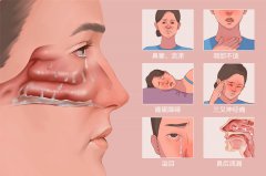 引起慢性鼻炎的原因有哪些？成都耳鼻喉醫(yī)院分析