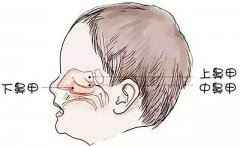 成都看鼻科口碑醫(yī)院_如何自查自己是否患有鼻甲肥大？